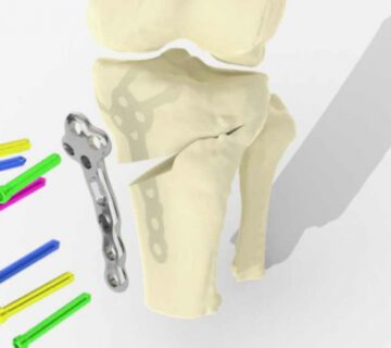 چاپ سه بعدی