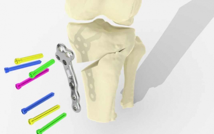 چاپ سه بعدی